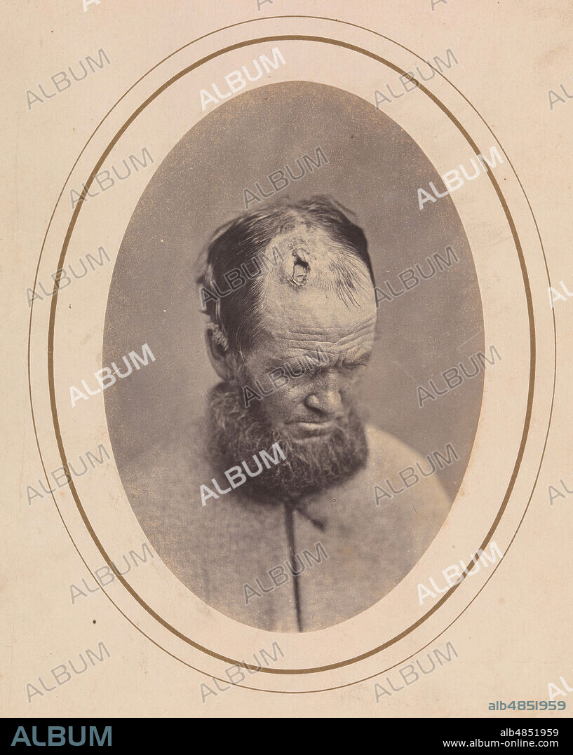 REED BROCKWAY BONTECOU. Private John Parkhurst, Company E, Second New York Heavy Artillery, 1865.