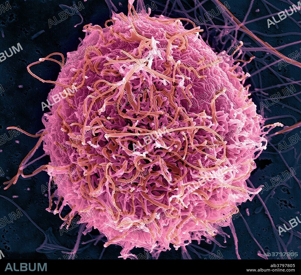 Scanning electron micrograph of filamentous Ebola virus particles budding from a single chronically-infected VERO E6 cell (25,000x magnification). Ebola hemorrhagic fever (Ebola HF) is a severe, often-fatal disease in humans and nonhuman primates (monkeys, gorillas, and chimpanzees) that has appeared sporadically since its initial recognition in 1976. The disease is caused by infection with Ebola virus, named after a river in the Democratic Republic of the Congo (formerly Zaire) in Africa, where it was first recognized. The virus is one of two members of a family of RNA viruses called the Filoviridae. There are four identified subtypes of Ebola virus. Three of the four have caused disease in humans: Ebola-Zaire, Ebola-Sudan, and Ebola-Ivory Coast. The fourth, Ebola-Reston, has caused disease in nonhuman primates, but not in humans. Vero cells are derived from the kidney of an African green monkey (Cercopithecus aethiops) in the 1960s, Vero cells are one of the most common mammalian continuous cell lines used in research. This anchorage-dependent cell line has been used extensively in virology studies.