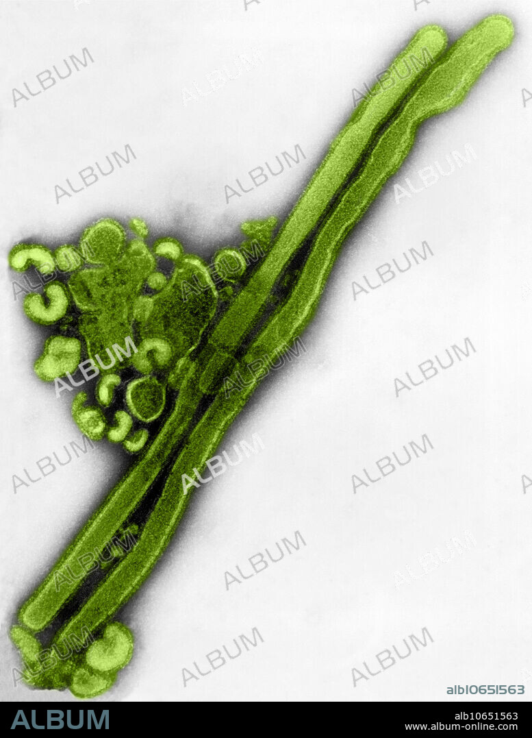 Negatively-stained transmission electron microscopic (TEM) image revealed the presence of a number of influenza virus virions. This virus is a Orthomyxoviridae virus family member. The Orthomyxoviruses are a family of RNA viruses that includes seven genera: Influenza virus A, Influenza virus B, Influenza virus C, Influenza virus D, Isavirus, Thogotovirus and Quaranjavirus. The first three genera contain viruses that cause influenza in vertebrates, including birds (see also avian influenza), humans, and other mammals. Influenza A and B viruses cause seasonal epidemics of disease almost every winter in the United States. Influenza C infections cause a mild respiratory illness and are not thought to cause epidemics.