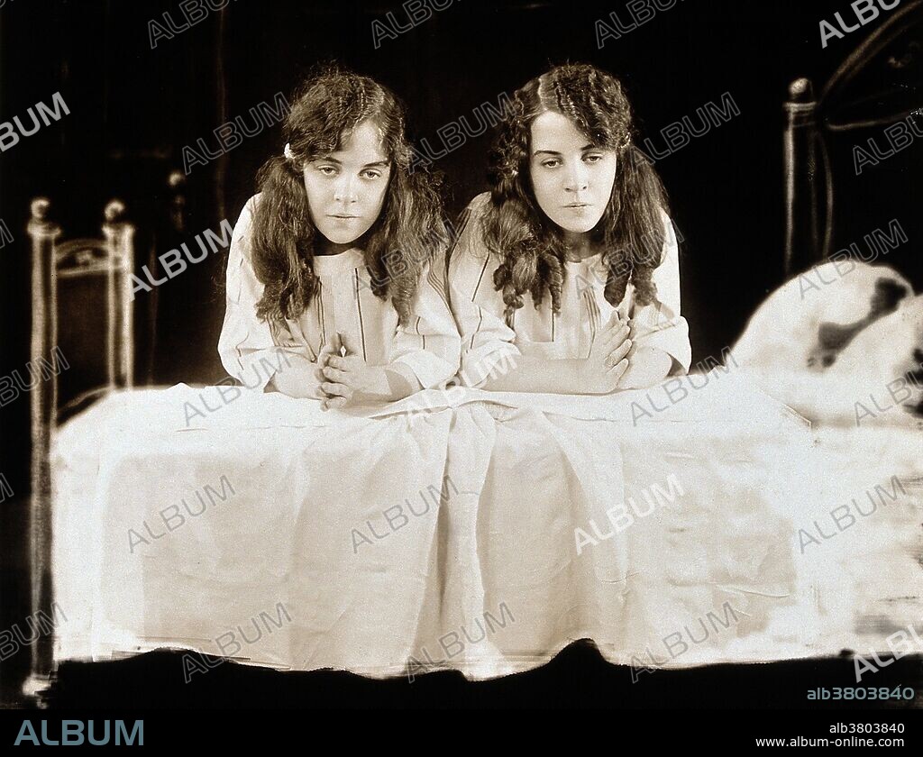 Entitled: "Daisy and Violet Hilton, conjoined twins, dressed for bed, kneeling to say their prayers." Daisy and Violet Hilton (February 5, 1908 - January 4. 1969) were a pair of English Siamese Twins, joined by their hips and buttocks; they shared blood circulation and were fused at the pelvis but shared no major organs. Their mother worked in a bar and sold the twins to her boss, who toured them around the world. They gained recognition in Germany, the US and Australia and tap danced in a Bob Hope act. They gained independence in 1931 and went into vaudeville. Violet was a saxophonist and Daisy a violinist. After vaudeville lost popularity, the sisters performed in burlesque, and struggled to make a living. Their last public appearance was in 1961 at a drive-in cinema in Charlotte, North Carolina. Their manager abandoned them there, and with no means of transportation or income, they were forced to take a job in a nearby grocery store. In 1969, after they failed to report to work, their boss called the police. The twins were found dead in their home, victims of the Hong Kong flu. According to a forensic investigation, Daisy died first; Violet died between two and four days later. They were 60 years old. Progress Studio, New York, 1927.