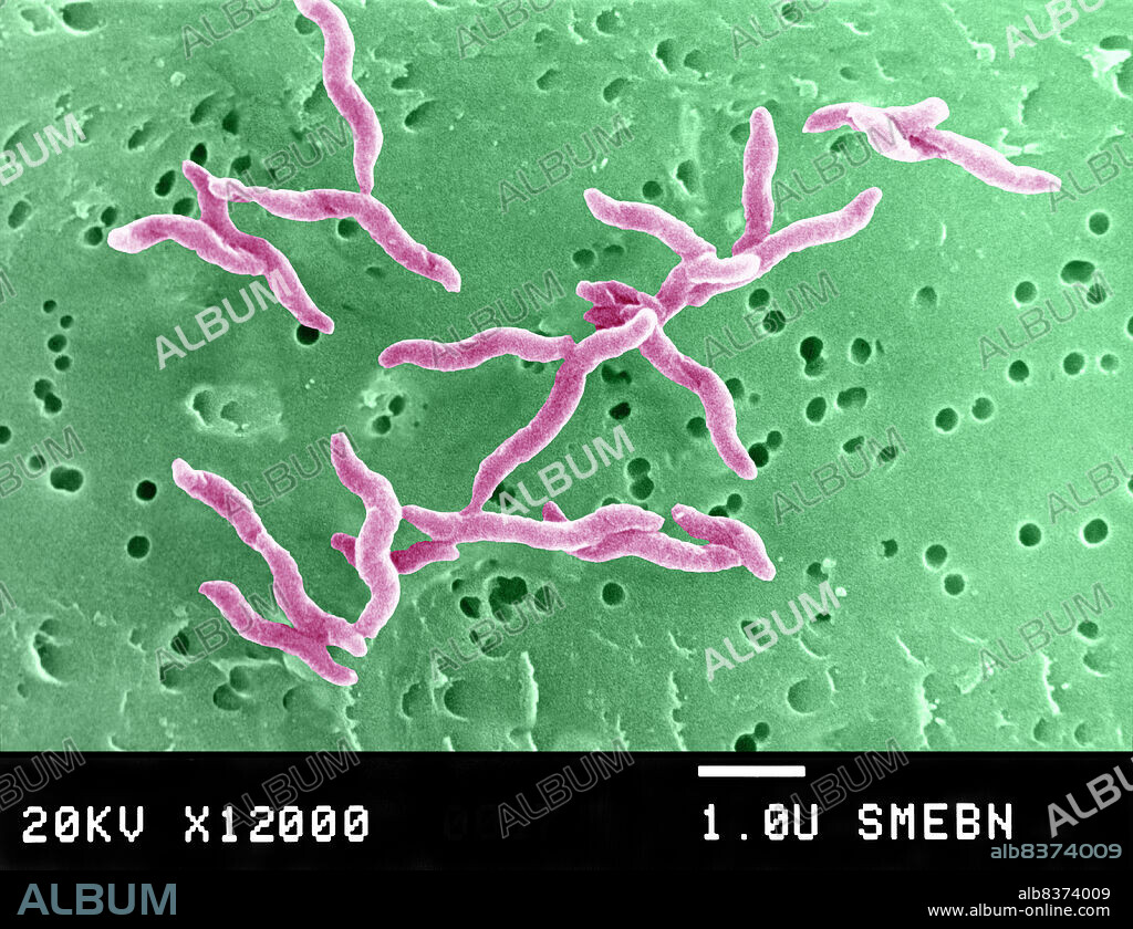Campylobacter is a family of curved Gram-negative bacteria. Several species have been identified. Campylobacter pylori (the causal agent of gastritis, ulcers...), Campylobacter fetus, and Campylobacter jejuni. Scanning electron microscopy of Campylobacter jejuni. SEM 12000x.