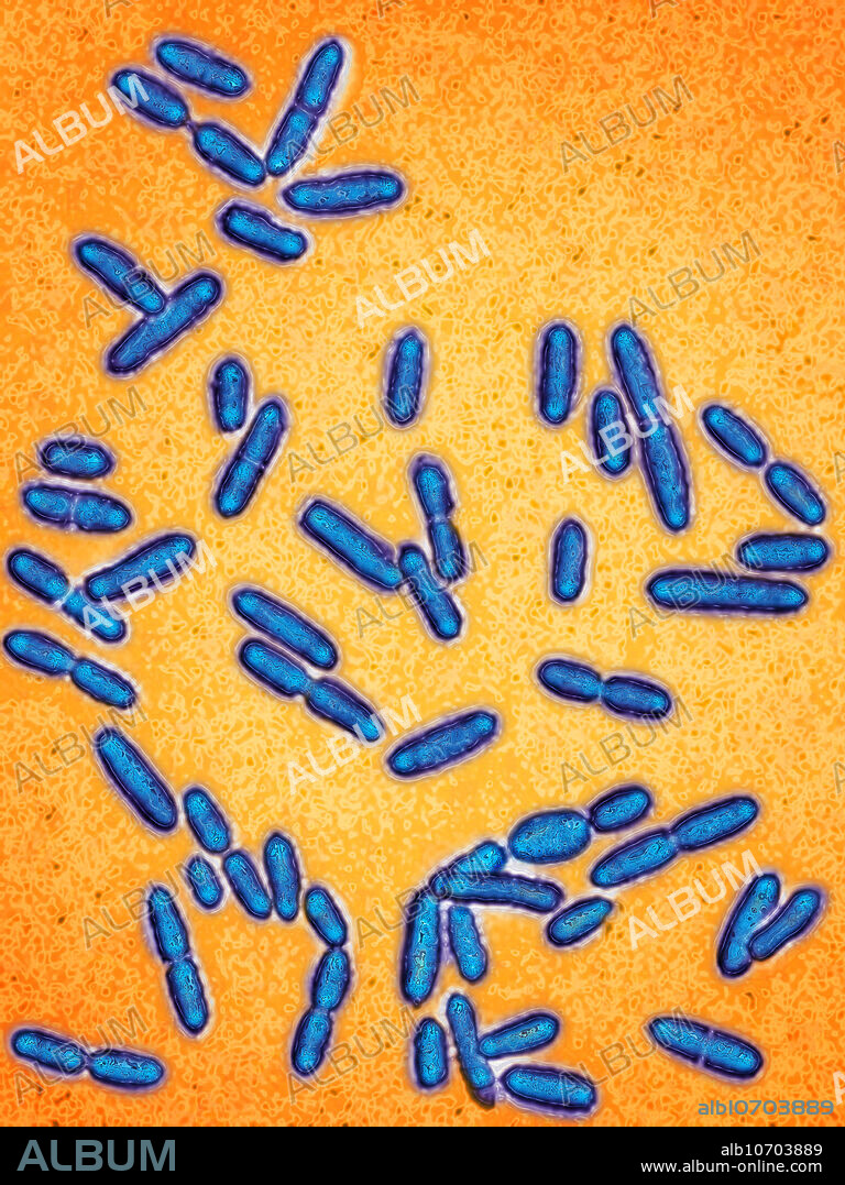 Colorized light micrograph showing Listeria monocytogenes, a pathogenic bacteria which can cause diverse flu-like symptoms. When a developing foetus is involved, the disease can be more serious, resulting in miscarriage, neonatal meningitis, or granulomatosis infantiseptica resulting from the transplacentaire contagion. Image colorization and HDRI treatments on optical microscopy; magnification X1000.