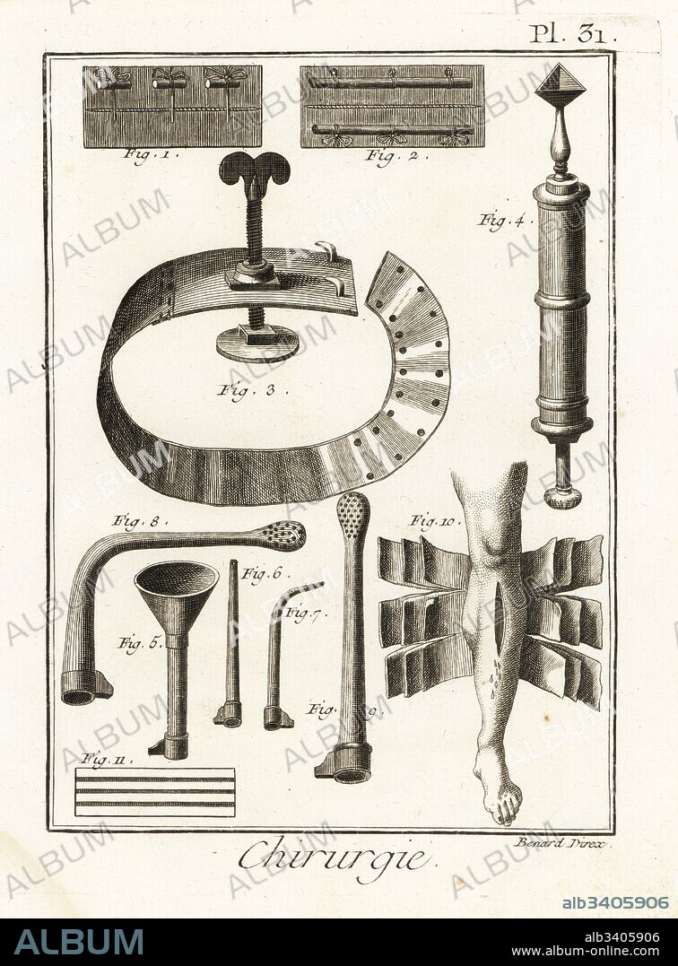 18th century sutures 1,2, tourniquet 3, Dominique Anel's fine-pointed syringe 4, siphon 5, injection tubes 6-9, 18-sheet bandage for complex fractures 10 and graded compress 11. Copperplate engraving by Robert Benard from Denis Diderot's Encyclopedia, Pellet, Geneva, 1779.