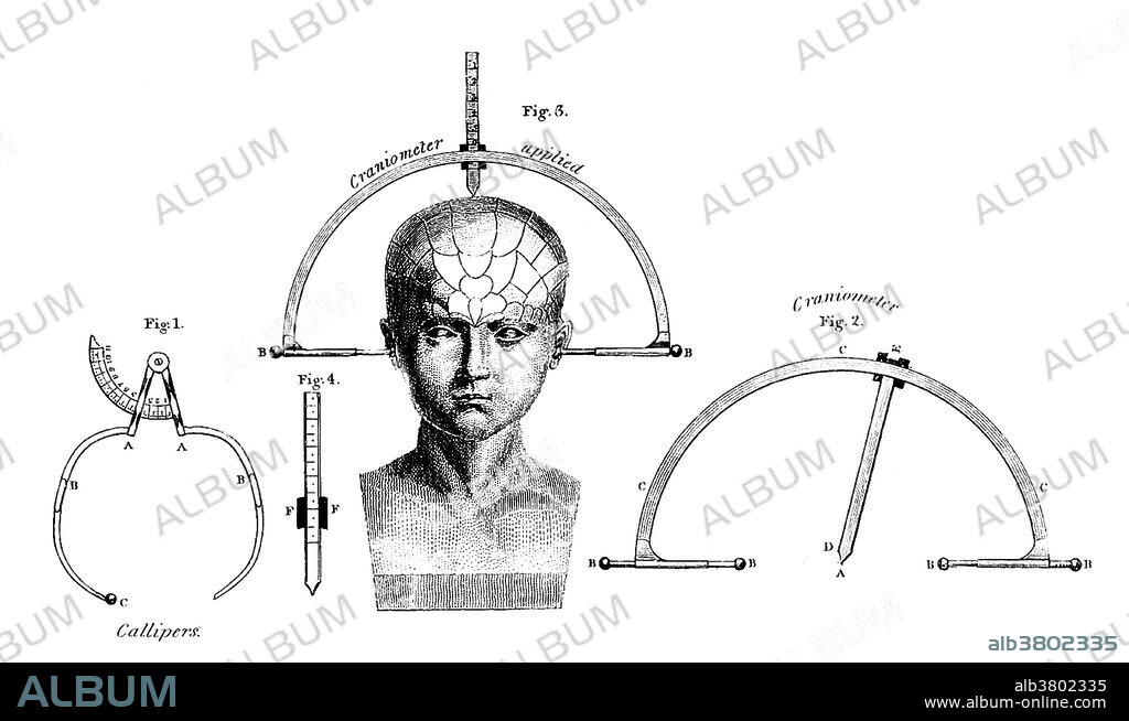 Phrenology is a pseudoscience primarily focused on measurements of the human skull, based on the concept that the brain is the organ of the mind, and that certain brain areas have localized, specific functions or modules. Although both of those ideas have a basis in reality, phrenology extrapolated beyond empirical knowledge in a way that departed from science. Developed by German physician Franz Joseph Gall in 1796, the discipline was very popular in the 19th century, especially from about 1810 until 1840. Although now regarded as an obsolete amalgamation of primitive neuroanatomy with moral philosophy, phrenological thinking was influential in 19th century psychiatry. Gall's assumption that character, thoughts, and emotions are located in specific parts of the brain is considered an important historical advance toward neuropsychology. Appeared in "Elements of Phrenology" by George Combe, 1824.