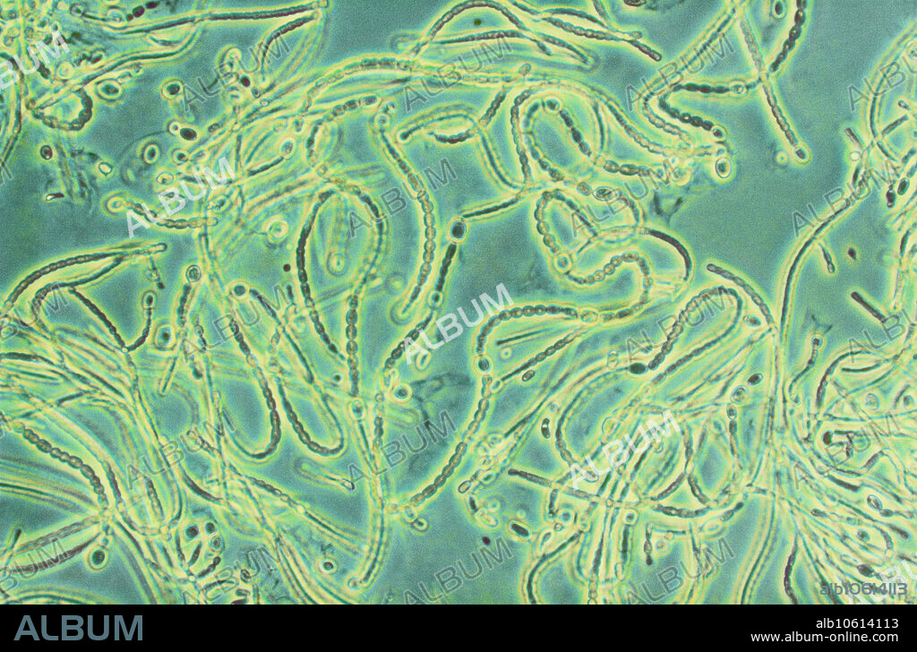 Light micrograph of rivularia bacteria; filaments have terminal heterocysts and vegetative cells tapering to a hair point. Magnification x100 at 35mm.