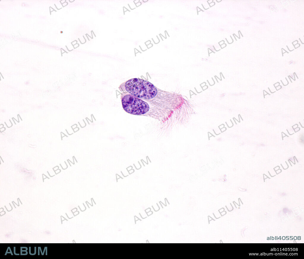 High magnification micrograph of ciliated epithelial cells isolated of human bronchi exudate. In the base of cilia there is a row of basal bodies. 100x at 10 mm.