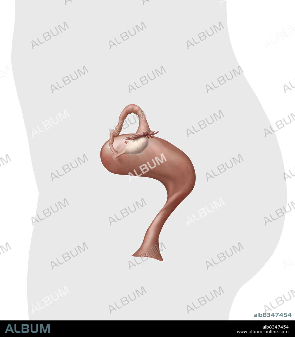 The uterus is a hollow organ located between the bladder and the rectum in which the fetus develops during gestation. It is connected to the fallopian tubes and the vagina. The uterus is made up of a dense wall of smooth tissue, the myometrium, covered with a mucous membrane, the endometrium. Highly expandable, the uterus stretches during pregnancy to reach 30 times its initial size.