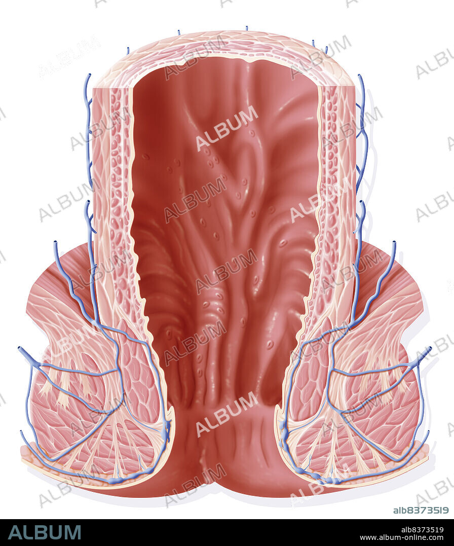 Représentation du rectum en coupe frontale avec mise en évidence de sa structure interne constitué en haut de plis et d'ampoules , plus bas de colonnes délimitant des valvules limité en bas par une ligne horizontale, la ligne ano-cutanée qui délimite en bas l'anus.. Mise en évidence des différentes structures musculaires constituant le rectum avec le plus à l'extérieur en bas le releveur de l'anus en dessous le muscle sphincter externe de l'anus et plus à l'intérieur le sphincter interne de l'anus.. Toute le rectum est largement vascularisé par le plexus veineux rectal et vers le bas les veines rectales inférieures.. C'est à ce niveau que se forment les hémorroïdes.