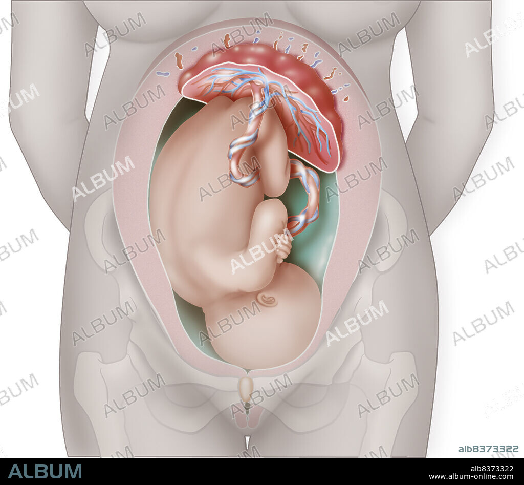 Illustration of a fœtus in the uterus in the 9th month of pregnancy, with the head down, its umbilical cord and placenta seen prominently. The endometrium and placenta are closely linked and allow blood flow between the mother and child.