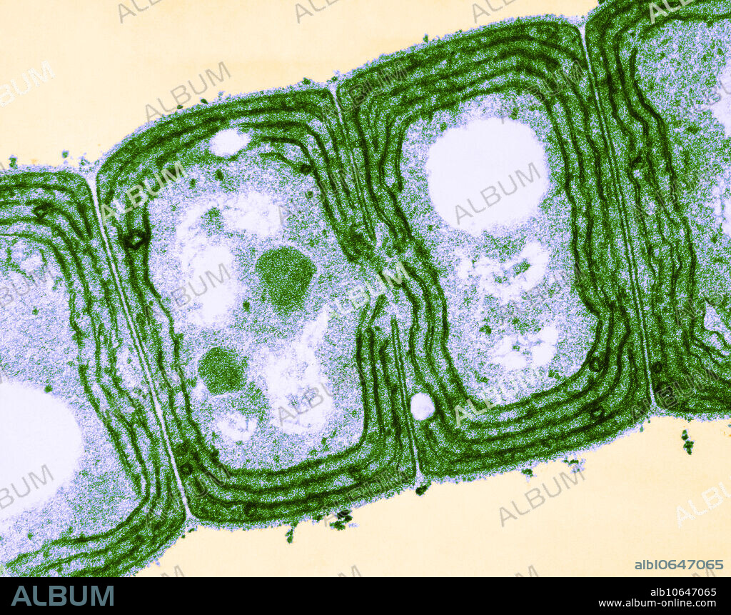Colour enhanced light micrograph of oscillatoria, a filamentous cyanobacteria; longitudinal section through a filament. Oscillatoria reproduces by fragmentation and gets energy through photosynthesis. It is often found in watering troughs. Magnification x80,000 @ 8x10.