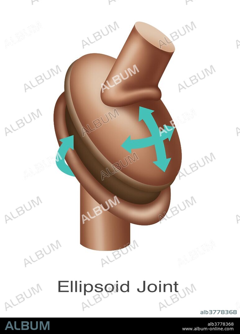 Illustration of an ellipsoid joint replacement.