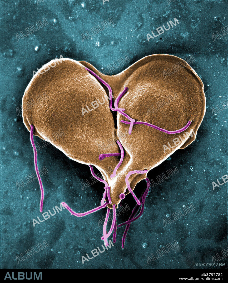 Colour-enhanced Scanning Electron Micrograph (SEM) showing a Giardia lamblia protozoan caught in a late stage of cell division, producing a heart-shaped form. This parasite inhabits the digestive tract of a wide variety of domestic and wild animal species, as well as humans, and causes the disease, Giardiasis.