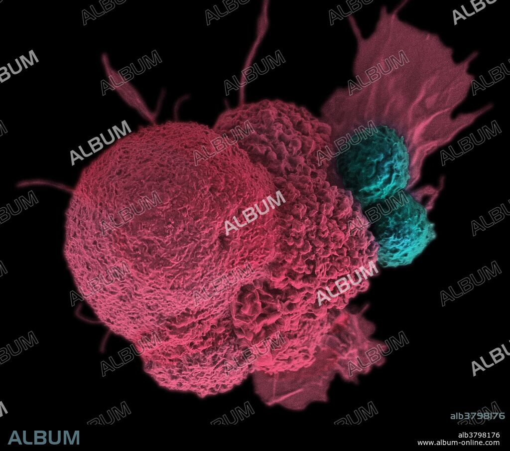 Oral Squamous Cancer Cell