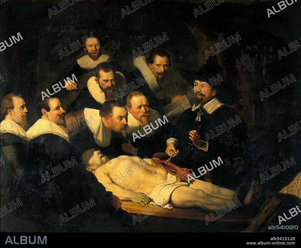 Entitled: "The Anatomy Lesson of Dr. Nicolaes Tulp" reproduction of painting by Rembrandt van Rijn. Human dissection is commonly practiced in the teaching of anatomy for students of medicine. No universal prohibition of dissection or autopsy was exercised during the Middle Ages. Some European countries began legalizing the dissection of executed criminals for educational purposes in the late 13th and early 14th centuries. The Anatomy Lesson of Dr. Nicolaes Tulp is a 1632 oil painting on canvas by Rembrandt. Tulp is pictured explaining the musculature of the arm to medical professionals. Some of the spectators are various doctors who paid commissions to be included in the painting. Oil painting after Rembrandt van Rijn (not original).