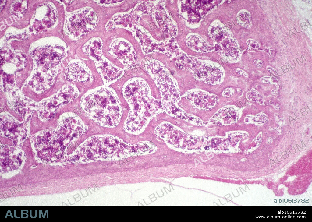 Cancellous Bone, light micrograph