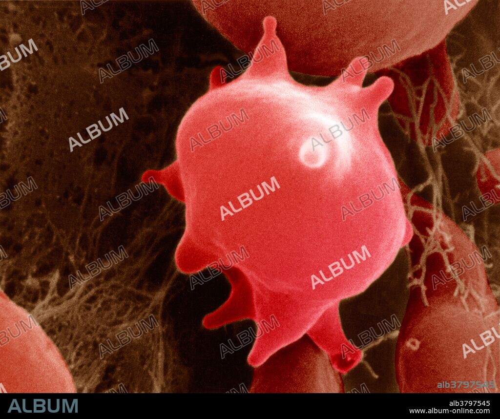 A red blood cell after exposure to a hypertonic solution showing an irregular shape as a result. Magnification 15,000x at 8" x 10". Enhancement of 9L6766.