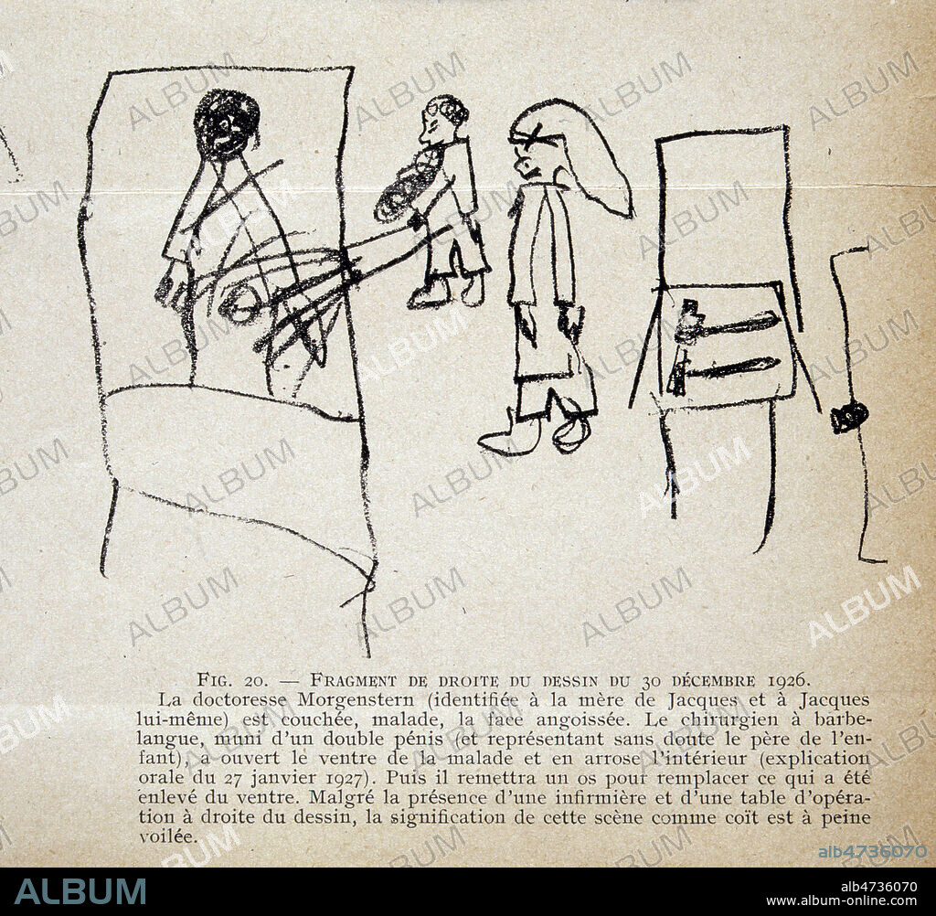Fig. 20. ¿ Fragment de droite du dessin du 30 décembre 1926..  La doctoresse Morgenstern (identifiée à la mère de Jacques et à lui-même) est couchée, malade, la face angoissée. Le chirurgien à barbe-langue, muni d¿un double pénis (et représentant sans doute le père de l¿enfant), a ouvert le ventre de la malade et en arrose l¿intérieur (explication orale du 27 janvier 1927). Puis il remettra un os pour remplacer ce qui a été enlevé du ventre. Malgré la présence d¿une infirmière et d¿une table d¿opération à droite du dessin, la signification de cette scène comme coït est à peine voilée. "Ayant constaté que l'unique moyen d'expression de Jacques était le dessin, je l'ai employé pour le traitement. Dès la première séance je l'ai fait dessiner. Je donnais à ces dessins des interprétations que Jacques approuvait ou désapprouvait par des signes de tête. C'est ainsi que je réussis à l'aider à exprimer ses conflits inconscients. Je lui demandais s'il avait un chagrin, lorsqu'il répondait affirmativement à ma question, je lui disais : « Dessine-le moi ». "Sophie Morgenstern, « Un Cas de Mutisme Psychogène », Revue Française de Psychanalyse, Première année, T. I, n° 3, Éd. G. Doin et Cie, 1927. 'Le mutisme psychogène infantile n'a, jusqu'à présent, été décrit nulle part. Dans le présent travail, je vais tâcher de montrer par quel conflit psychologique un enfant de 9 ans et demi s¿est trouvé emprisonné dans un mutisme qui a duré presque deux ans et dont le caractère spécial m'a permis de faire une étude psychanalytique assez étendue. C'est grâce à M. Heuyer que j'ai eu la possibilité de suivre de près et de soigner ce cas si intéressant et, jusqu'à présent, du moins à ma connaissance, unique.' Credit Jean VIGNE/KHARBINE TAPABOR.