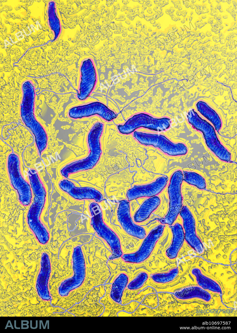Helicobacter pylori bacteria, light micrograph