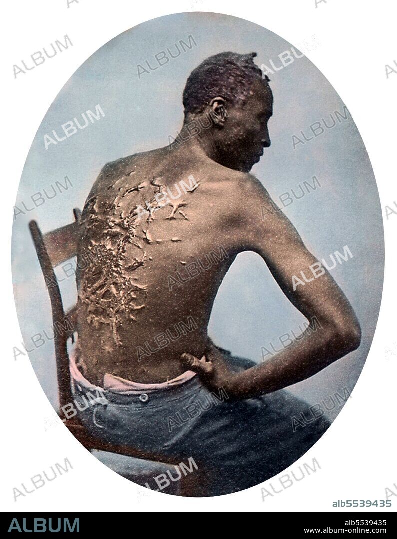 Gordon, or Whipped Peter, was a slave on a Louisiana plantation who made his escape from bondage in March of 1863 and went on to serve as a soldier in the United States Colored Troops. The photographs showing Gordon's flagellation scars were frequently used by abolitionists throughout the United States and internationally. In July of 1863 these images appeared in an article about Gordon published in Harper's Weekly, the most widely read journal during the Civil War. The pictures of Gordon's scourged back provided Northerners with visual evidence of brutal treatment of slaves and inspired many free blacks to enlist in the Union Army.
