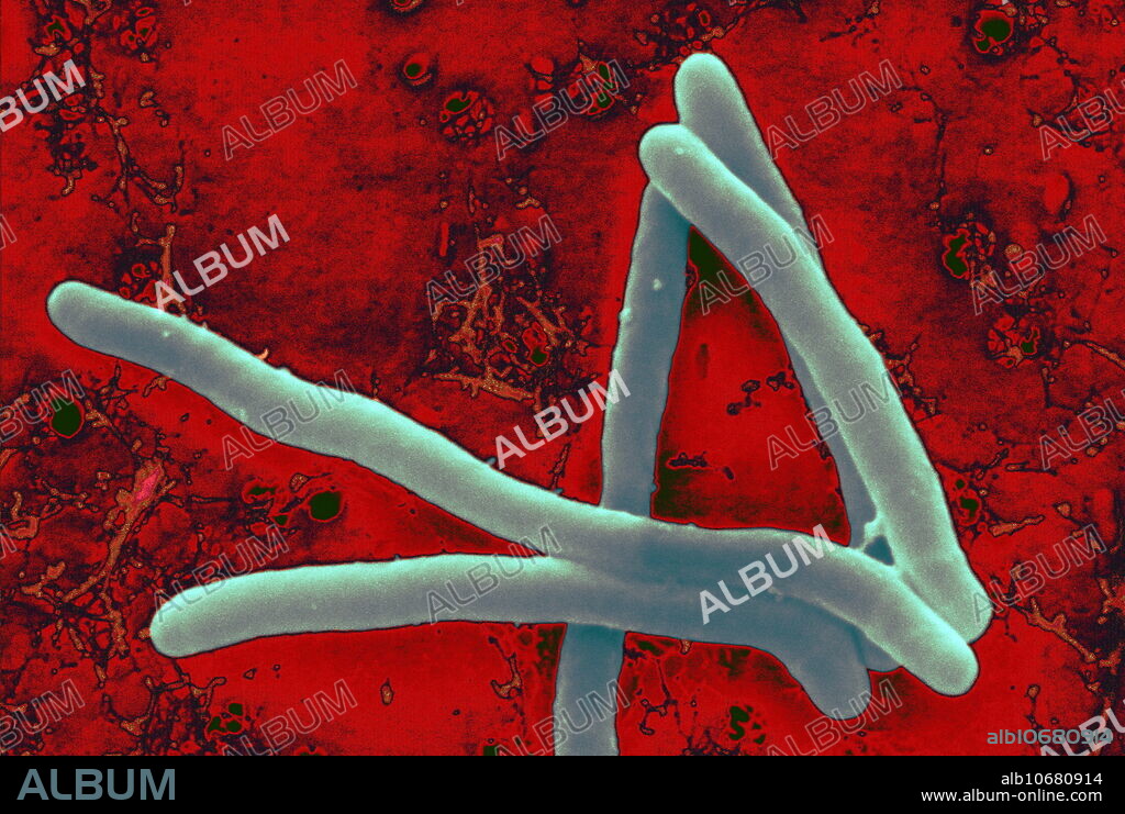 Mycobacterium smegmatis
