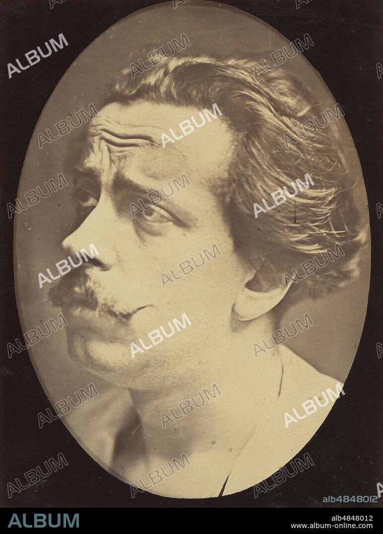 DUCHENNE DE BOULOGNE und ADRIEN ALBAN TOURNACHON. Figure 25: Not an expression of pain, 1854-56, printed 1862.