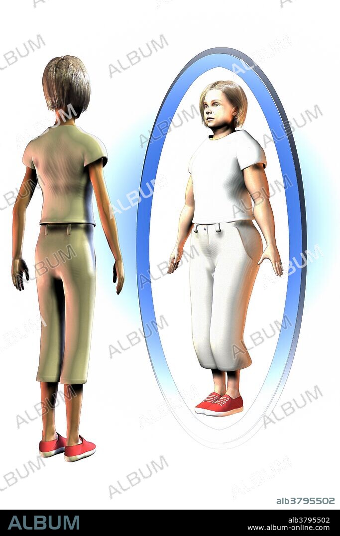 An illustration showing a very thin young woman who sees herself in a mirror as overweight. Body dysmorphia is a distorted view of your own body.