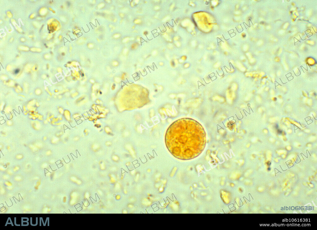 Entamoeba histolytica Cyst under a microscope