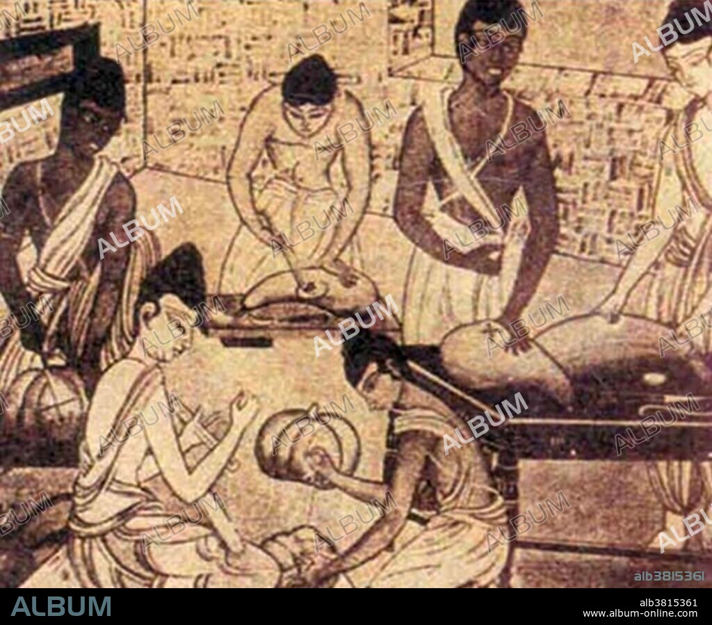 Saushrutas, Practicing Surgery, 800 BC Album alb3815361