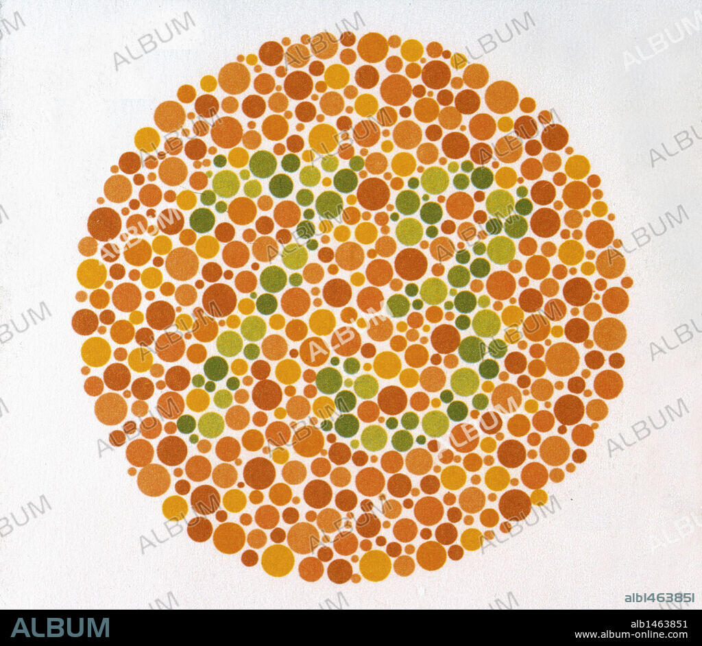 LAMINAS ISHIHARA. Método para diagnosticar el daltonismo. LAMINA Nº 4: Un individuo con visión normal lee un 73. En la mayoría de casos de deficiencias visuales cromáticas no pueden leerlo o lo leen incorrectamente.