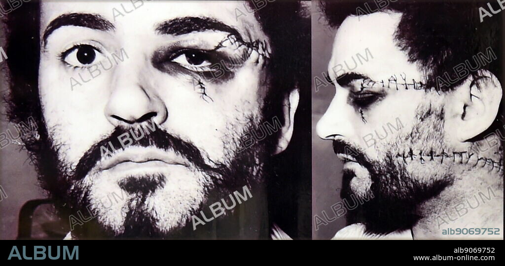 Peter William Sutcliffe (2 June 1946 - 13 November 2020), also known as Peter William Coonan, was an English serial killer who was dubbed the Yorkshire Ripper (an allusion to Jack the Ripper) by the press. On 22 May 1981, he was found guilty of murdering 13 women and attempting to murder seven others between 1975 and 1980. He was sentenced to 20 concurrent sentences of life imprisonment, which were converted to a whole life order in 2010. Two of Sutcliffe's murders took place in Manchester; all the others occurred in West Yorkshire.