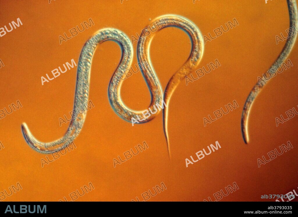 Vinegar eel, Turbatrix aceti, free-living nematodes that can be found feeding on the microbial culture called mother of vinegar that is use in the production of vinegar. They are non-parasitic and considered harmeless but are removed from vinegar by pasteurization. Magnification: 50x at 35mm.