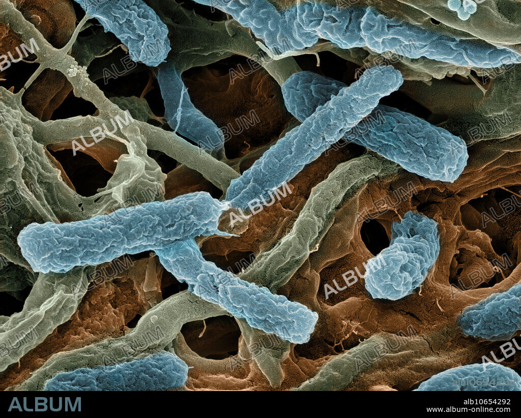 Scanning electron micrograph (SEM) of thermophilic bacteria (blue). Collected from 140 degree F water in the springs of Yellowstone National Park, Wyoming USA. This type of bacteria is adapted to thrive at high water temperatures and is currently the focus of biological researchers. Bacteria that can live in these extreme conditions are called thermophiles or extremophiles. Typically, the hotter the temperature the smaller the bacteria. Shot at 17,131X magnification with a field of view of 7 um.