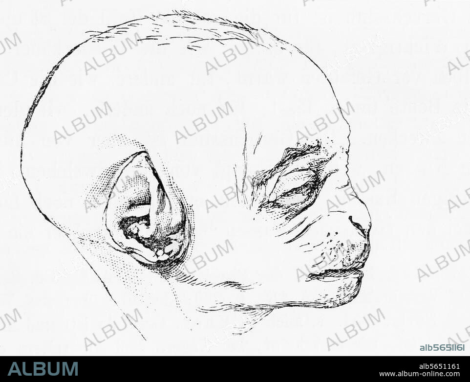 ANONYMOUS. Darwin, Charles Robert; British biologist; 1809-1882. Work: The Descent of Man, and Selection in Relation to Sex (1871). "Foetus of an Orang". Woodcut. From the German translation by J. V. Carus, vol. 1, 3rd ed. Stuttgart (E. Schweizerbarth'sche Verl. h.) 1875, p. 21. Berlin, Sammlung Archiv für Kunst und Geschichte.