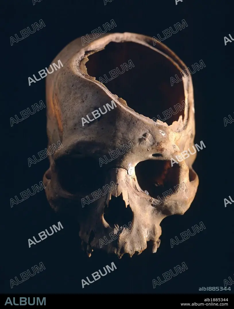 Skull showing the trepanation practiced by the Indians, from Peru. Pre-Inca  Paracas Civilization, 6th Century BC. - Album alb1885344