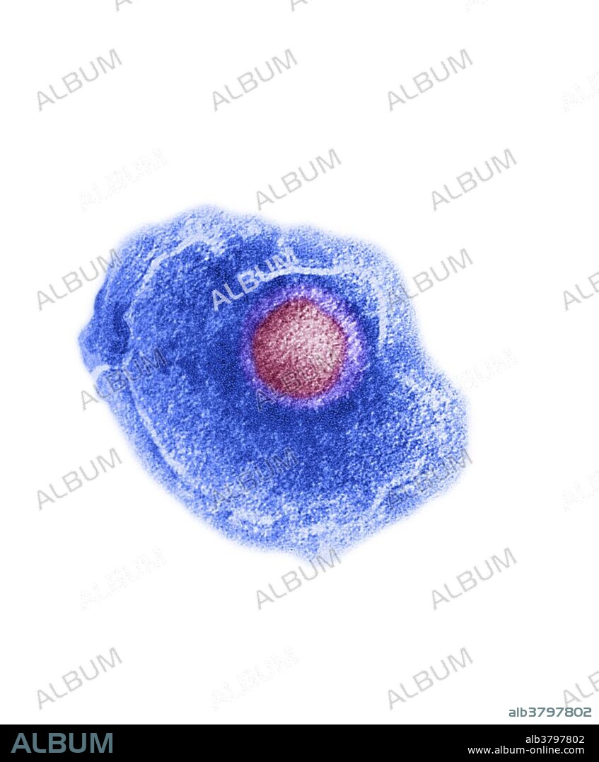 【限定150】ホアンコルネラ 「Humans Are A Virus」 【模写】 Anti-Ebola virus GP1 antibody (GTX134144) | GeneTex