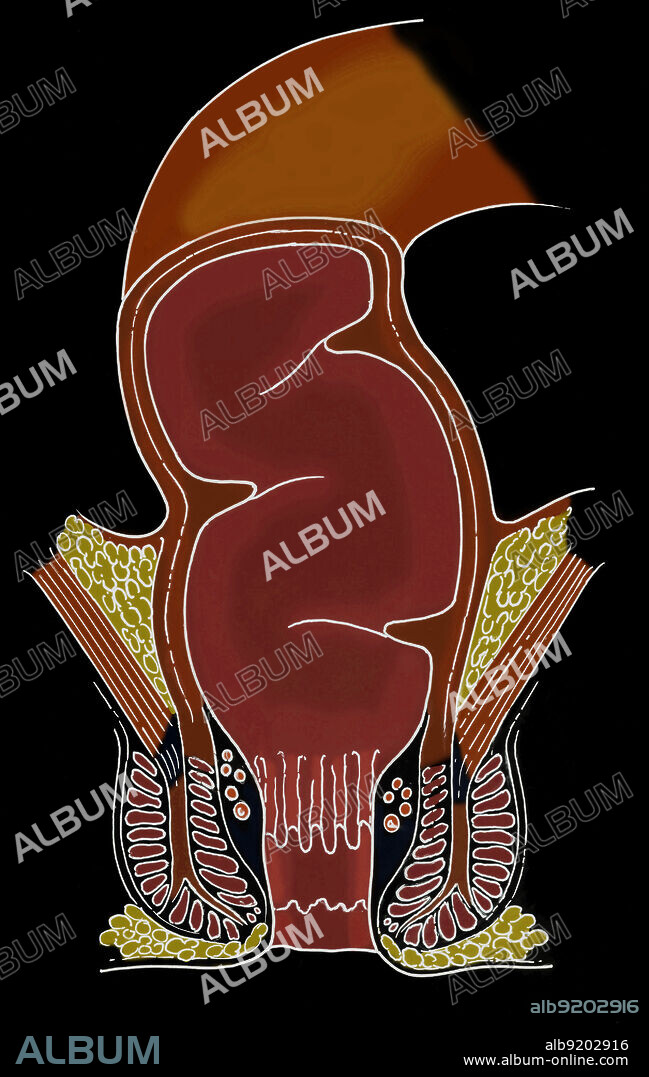 Anatomical illustration of rectum in frontal section, showing anus, anal canal, sphincter muscle, anal columns, levator ani muscle, internal rectum, and transverse fold.