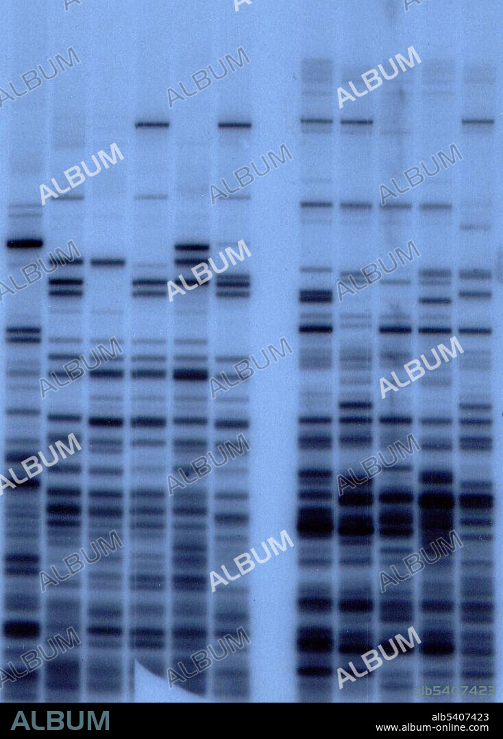 An early DNA fingerprint showing DNA patterns from a mother (lanes 2 and 8) and her four children (adjacent lanes to the right). Lane 1 is an unrelated person. The two sets of lanes show the fingerprints reveled with two different probes that detect different types of repeated sequences. DNA profiling (also called DNA fingerprinting, DNA testing, or DNA typing) is the process of determining an individual's DNA characteristics, called a DNA profile, that is very likely to be different in unrelated individuals, thereby being as unique to individuals as are fingerprints (hence the alternative name for the technique). Supplied by Alec Jeffreys courtesy of Wellcome Images.