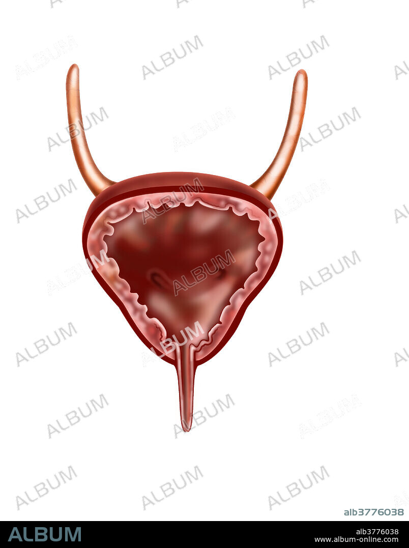 The urinary bladder is the organ that collects urine excreted by the kidneys before disposal by urination. A hollow muscular, and distensible (or elastic) organ, the bladder sits on the pelvic floor. Urine enters the bladder via the ureters and exits via the urethra.