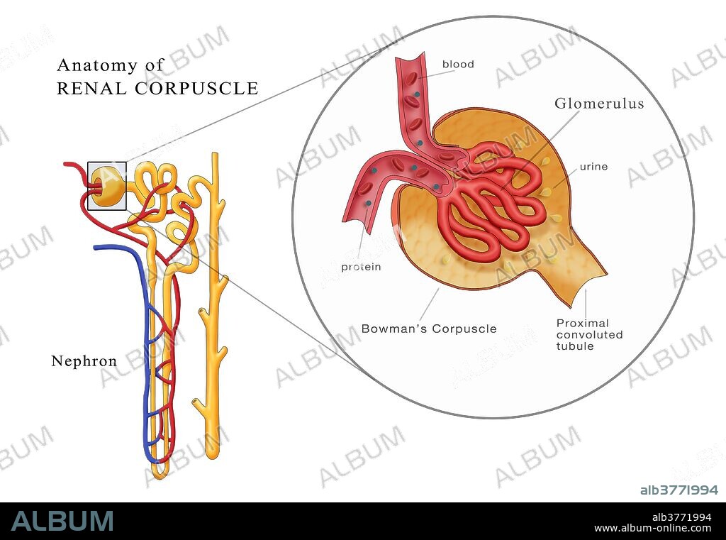 Illustration of the anatomy of a renal corpuscle. At left is the full structure of a nephron and at right is a detailed diagram of kidney glomerulus. Diagram shows the afferent arteriole, bowman's capsule, efferent arteriole, and proximal convoluted tubule.