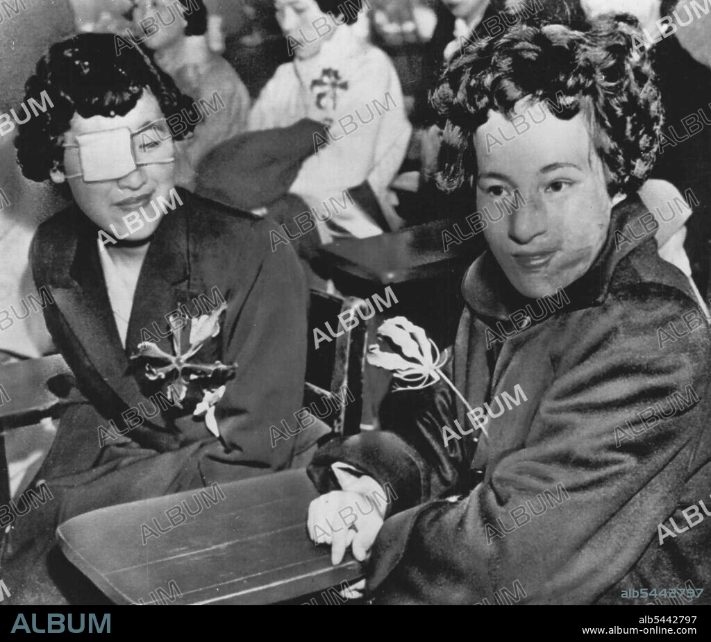 Hiroshima A-Bomb Survivors Face Brighter Future -- Japanese girls Mitsuko Kuranoto, left, and Emiko Takemoto, survivors of the Hiroshima atom bomb 10 years ago, face newsman and photographers at Mitchel Air Force base, Long Island, today. Twenty-five Japanese girls, scarred by the blast, made the 6,700 mile trip here cautiously hopeful that the miracle of plastic surgery can give them new faces. Are these Japanese girls doomed to die? They were among 25 survivors from the A-bomb explosion at Hiroshima in 1945, flown to Mt. Sinai Hospital, New York *****. May 09, 1955. (Photo by AP Wirephoto).
