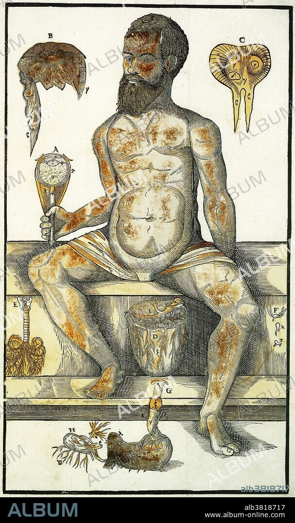 Anatomical Fugitive Sheet, Andreas Vesalius, 1573