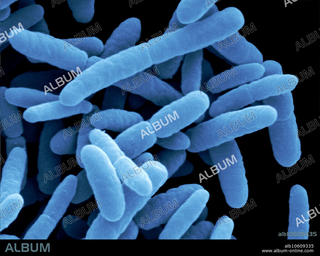 Escherichia coli bacteria by scanning electron microscopy (SEM). E. coli are present in the intestinal contents of aniamls and are thus also called the intestinal rods. They are used as indicators of contamination with fecal material. In the past, some of these originally harmless bacteria developed toxins and became a serious health hazard to humans and animals. Enhanced SEM: Image width: 9.1 micrometers; magnification: 10,990x if the image is printed 10 cm wide.
