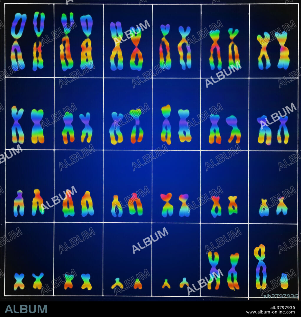 Colour enhanced micrograph of normal male chromosomes. This karyotype shows the 46 chromosomes found in most cell nuclei in a man's body. There are 22 pairs of chromosomes and also the gender determining pair (lower right corner). In men, this comprises one X and one Y chromosome. In women, it is made up of two X chromosomes. The Y chromosome carries genetic information responsible for the development of male characteristics. Chromosomes carry genetic information in the form of genes, lengths of DNA that act as recipes for proteins. Karyotypes are an arrangement of chromosomes based on their appearance under a light microscope.