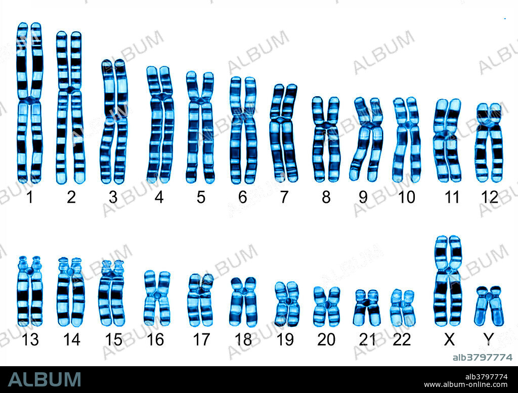 Human chromosomes. The human karyotype is composed of 23 pairs of chromosomes, including 1 pair of sexual chromosomes (XX for the female, XY for the male). The chromosomes carry genetic information, formed by a long DNA molecule, associated with proteins. Illustration of microscopy. Magnification: 3900x per 10 cm.