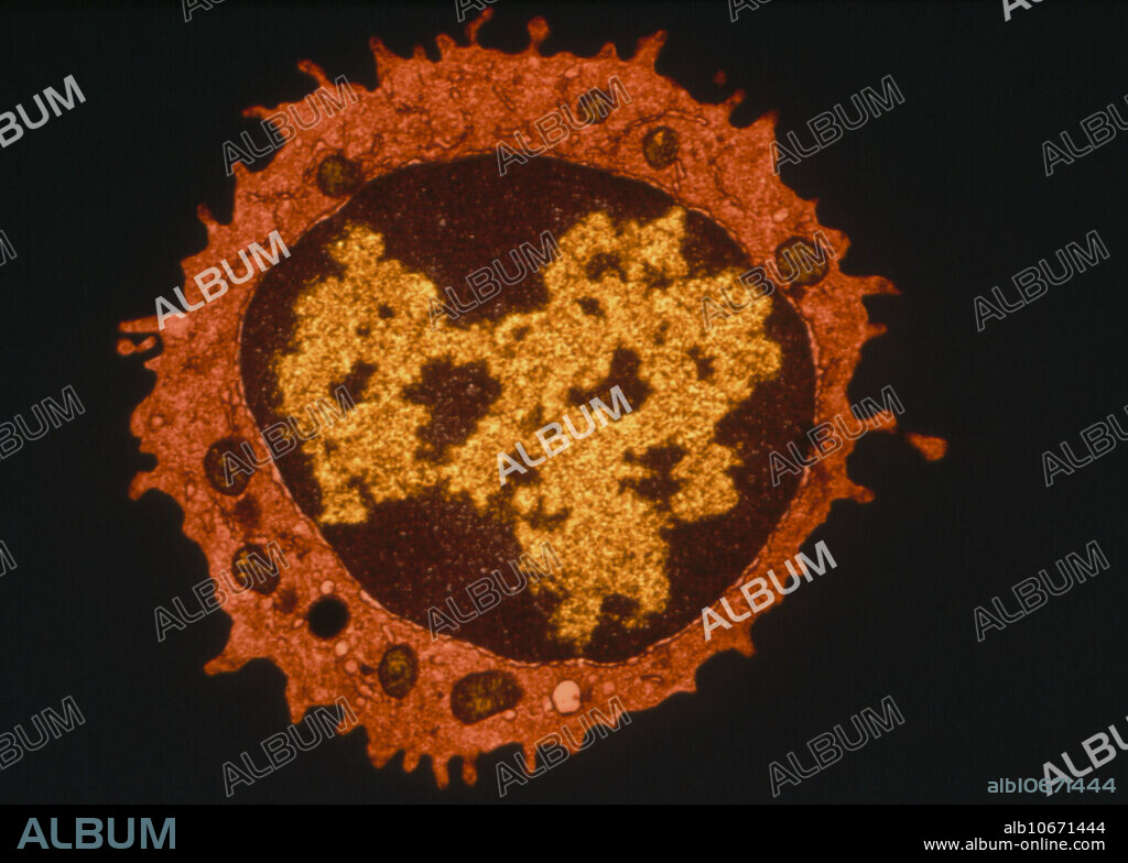 T-lymphocyte. Coloured transmission electron micrograph (TEM) of a section through a T-lympho- cyte white blood cell. At centre, the large nucleus is seen (brown) with chromatin (yellow). Characteristic of normal T-lymphocytes are long microvilli which project from the cell surface. Mitochondria (brown) are seen in the cell cytoplasm (orange). T-lymphocytes are cells of the human immune system, produced in bone marrow and which mature in the thymus gland. They help to protect the body against invasion by bacteria, viruses and other foreign substances. T-cells are attacked by the human immunodeficiency virus (HIV) which causes AIDS.
