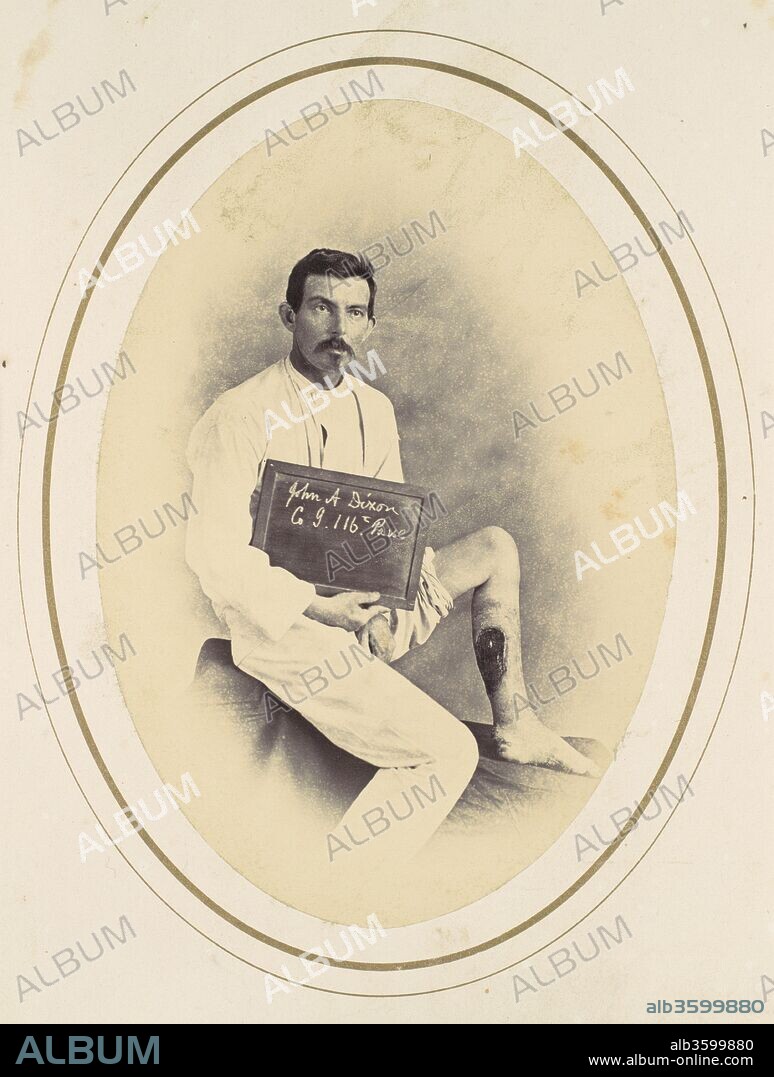 John A. Dixon. Artist: Reed Brockway Bontecou (American, 1824-1907). Date: 1865.