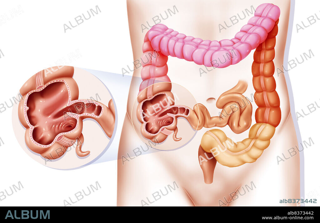 Colon and large intestine, with a focus on the caecum.