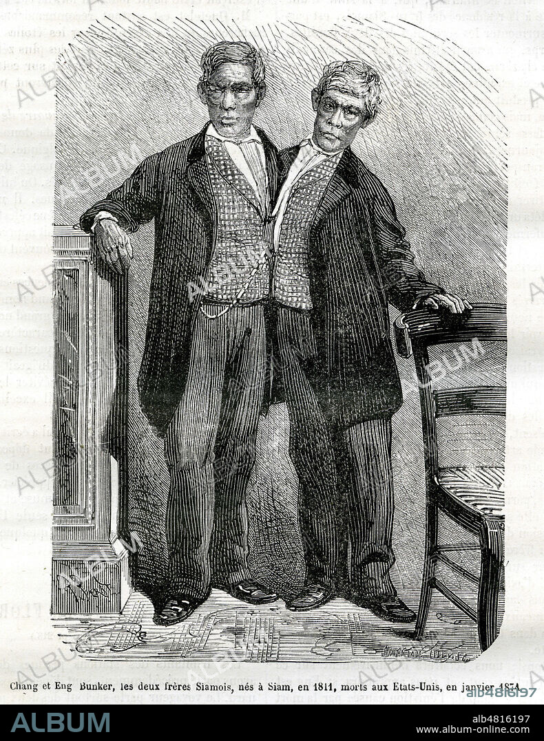 'Chang et Eng Bunker, les deux freres siamois, nes a Siam en 1811, morts aux Etats Unis en janvier 1874'. Ce sont eux qui ont donne naissance au terme 'siamois'. Illustration par Ferat tiree de la revue La Nature du 14 mars 1874. Credit : Collection KHARBINE-TAPABOR.
