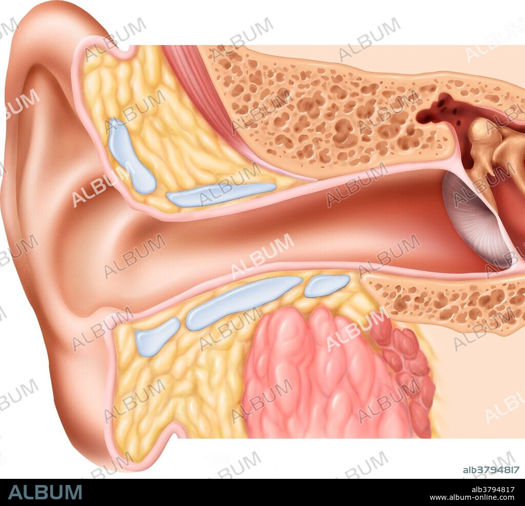 Illustration of the normal ear canal. The inner ear contains a maze of fluid-filled passages called the labyrinth. The cochlea is a hollow spiral containing microscopic hairs that respond to sound vibrations conveyed from the middle ear. The near end of the spiral picks up high-frequency sound; the central (far) end detects low frequency sound. Nerves connected to the cochlea carry sound impulses to the brain. The semi-circular canals provide the sense of balance by detecting movement of fluid through the three planes.