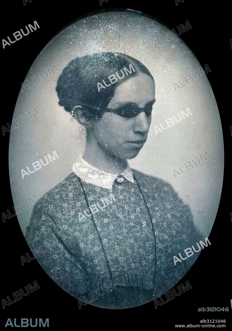 Photographic portrait of Laura Bridgman (1829-1889) First deaf-blind American child to gain a significant education in the English language. Photographed by Southworth & Hawes, an early photographic firm in Boston. Dated 1855.